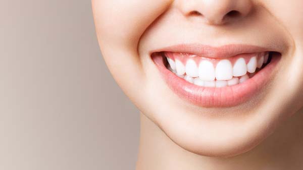 What Is Dental Bonding?