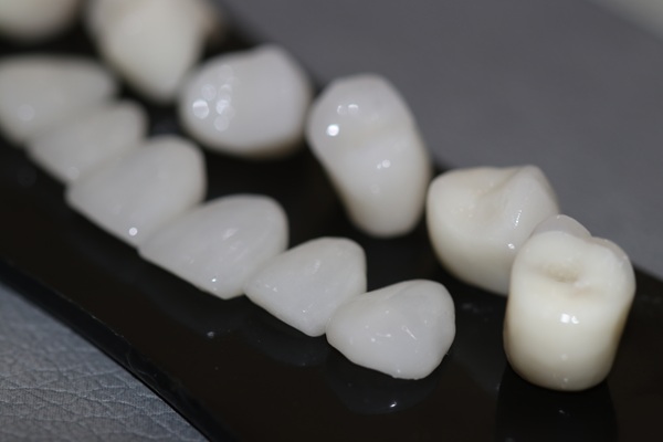 Why You May Need A Dental Crown After Root Canal Therapy