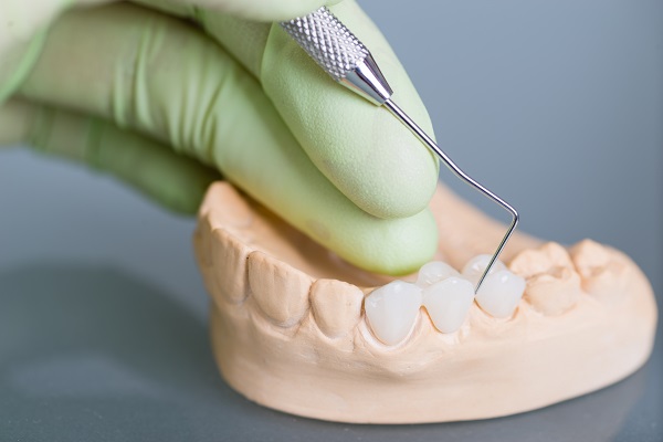 Dental Restoration Options: Dental Crowns