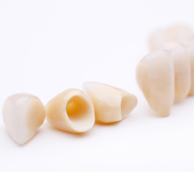Dental Crowns and Dental Bridges
