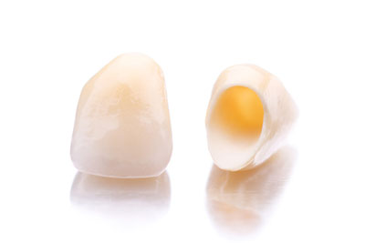 Reasons To Choose Porcelain Crowns