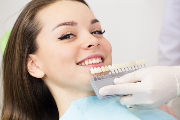 The   Most Commonly Asked Questions About Dental Veneers