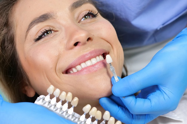Traditional Dental Veneers Vs  No Prep Veneers: Differences To Keep In Mind