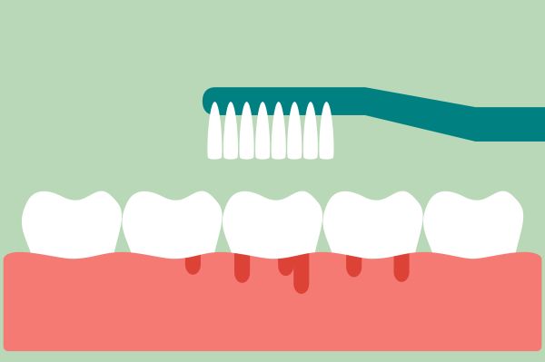 Periodontics Los Angeles, CA