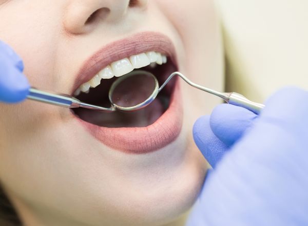 Dental Implant Professional FAQs