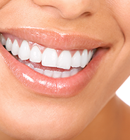 Teeth Whitening Services Los Angeles, CA