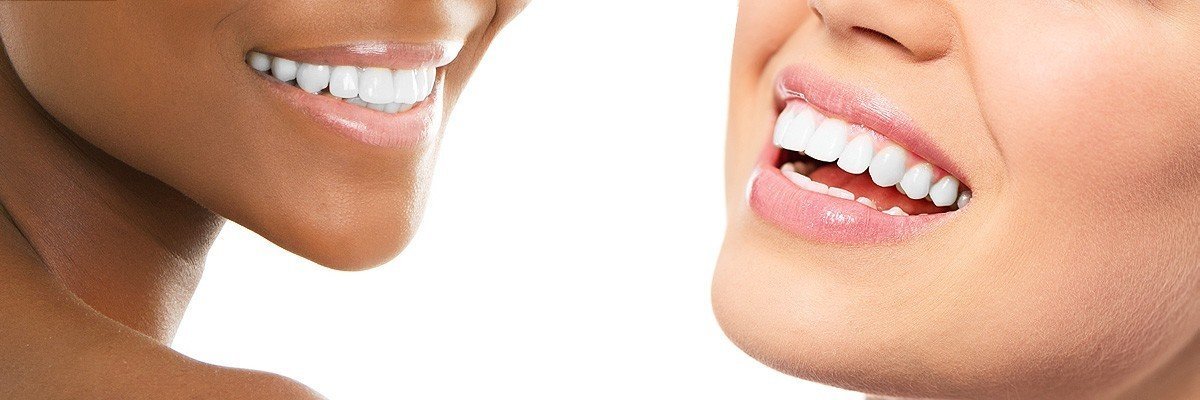 Los Angeles Dental Restoration