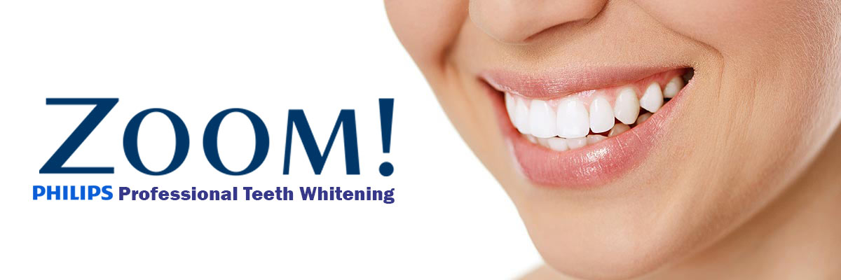 Los Angeles Zoom Teeth Whitening